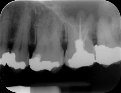 Huge itfxmx - Eugenol