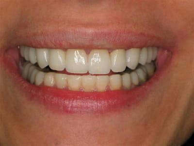 Haut c ram d1pcuf - Eugenol