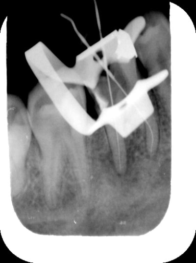 Herve1 srtd1v - Eugenol