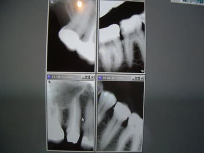 Imgp0196 e7xlek - Eugenol