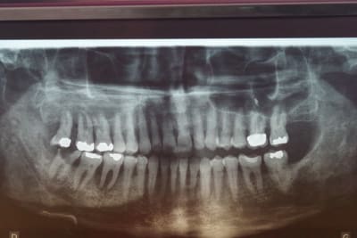 Imgp1389 pcwpid - Eugenol