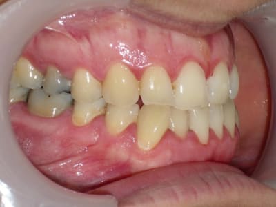 Imgp8146 uudoem - Eugenol