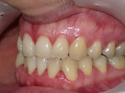 Imgp8147 vyv2a2 - Eugenol