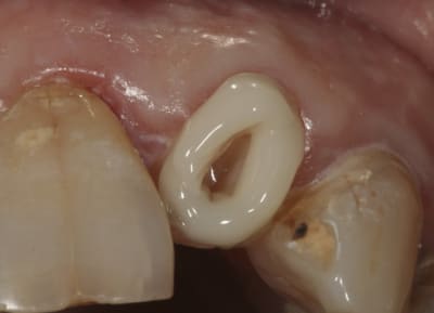 Img 0008 lvy5wo - Eugenol