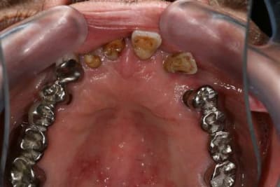 Img 0009 gfmvjt - Eugenol