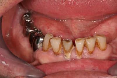 Img 0011 jwofqm - Eugenol