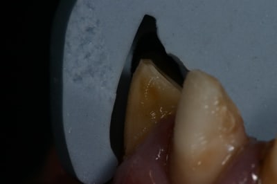 Img 0020 ivwahl - Eugenol