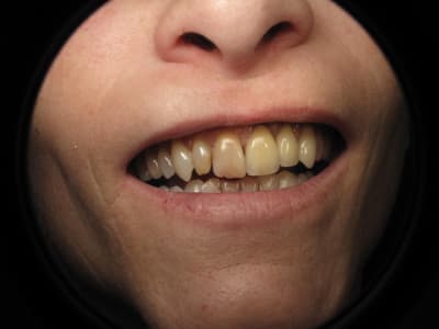 Img 0057 z0wmh1 - Eugenol