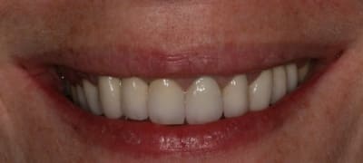 Img 0081 szqy9r - Eugenol