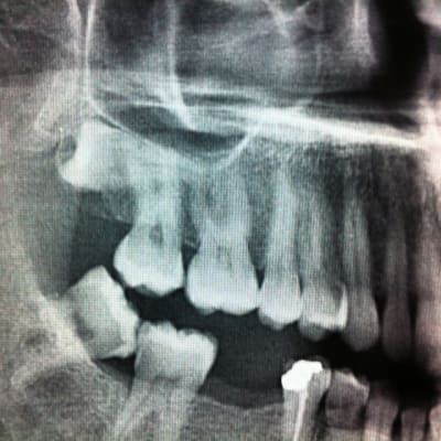 Img 0120 fcv0hb - Eugenol