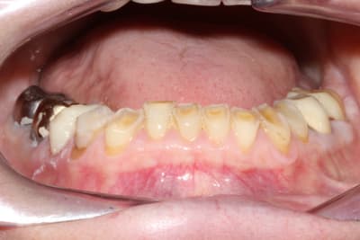 Img 0218 a8ksr0 - Eugenol