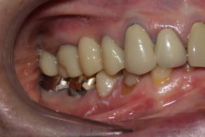 Img 0220 riollb - Eugenol