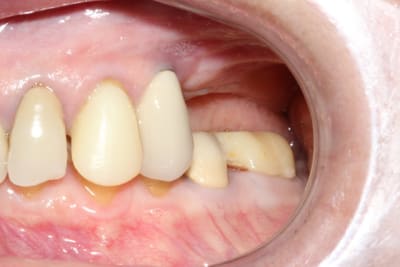 Img 0222 rrg1le - Eugenol
