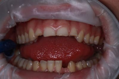 Img 0260 tyrelw - Eugenol