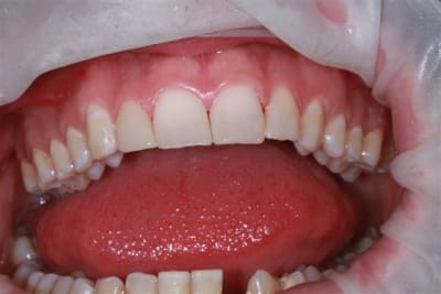 Img 0262 jmduhj - Eugenol