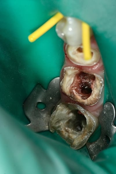 Img 0281 ltybjl - Eugenol