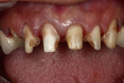 Img 0306 dlekdx - Eugenol