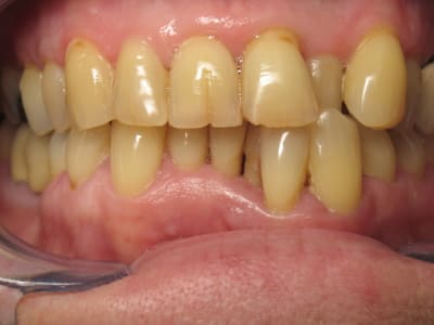 Img 0479 f9ynyp - Eugenol