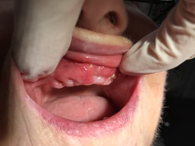 Img 0488 zymvt8 - Eugenol