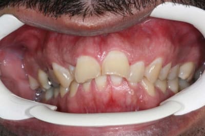 Img 0681 qwaopa - Eugenol