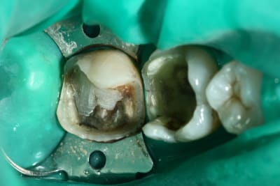 Img 0685 ifiupf - Eugenol