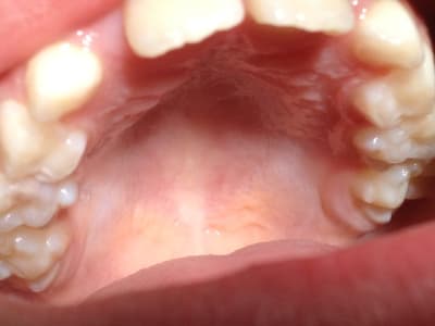 Img 0693 niusds - Eugenol