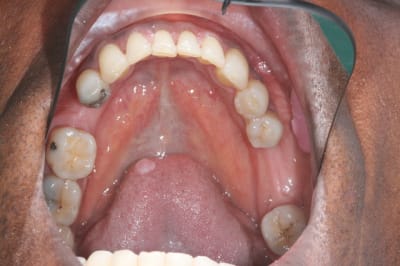 Img 0718 weqxng - Eugenol