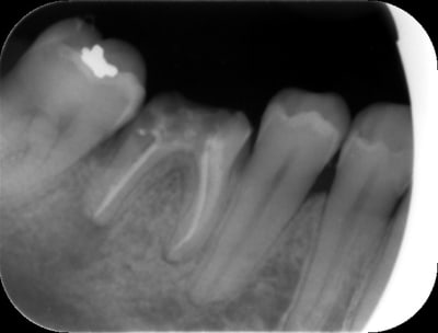 Img 0816 dwoxje - Eugenol