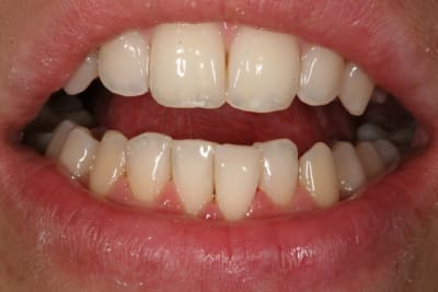 Img 0819 xr9ik0 - Eugenol