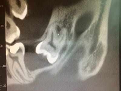 Img 0856 ulmlrl - Eugenol