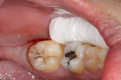 Img 0887 se8lba - Eugenol