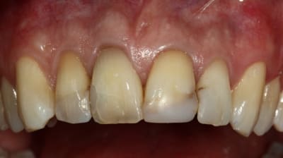 Img 0957 u8frpw - Eugenol