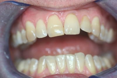 Img 1017 u3luwu - Eugenol
