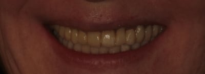 Img 1027c jw5nzx - Eugenol