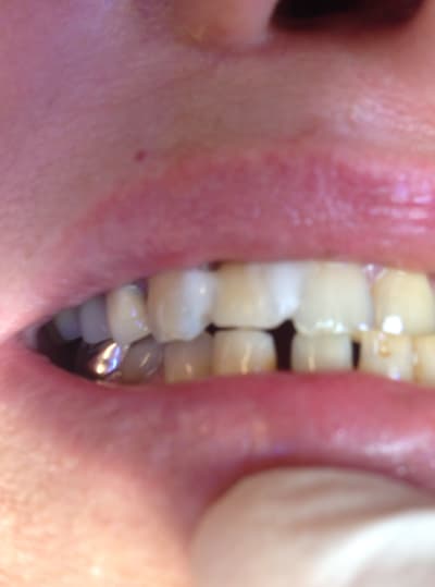 Img 1062 qiuel9 - Eugenol