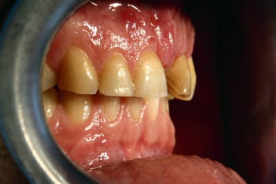 Img 1173 tih5r1 - Eugenol