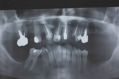 Img 1238proper x9tesd - Eugenol