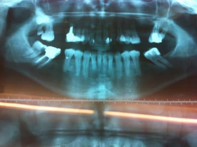 Img 1241 i3c25n - Eugenol