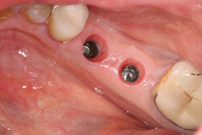 Img 1244 xufbcd - Eugenol