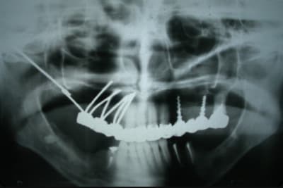 Img 1246 hr61cm - Eugenol