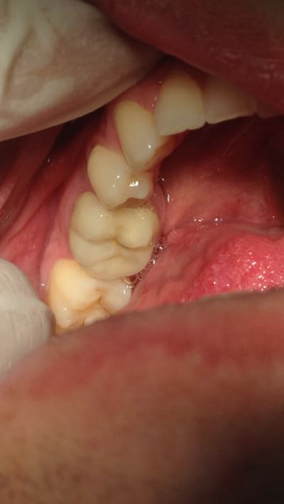 Img 1355 flis1j - Eugenol