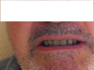 Img 1360 modif sjyl4t - Eugenol