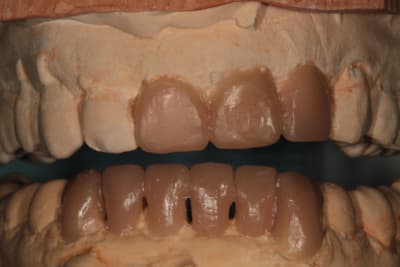 Img 1589 b6dje6 - Eugenol