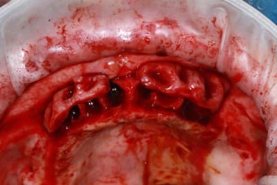 Img 1671 jy1yif - Eugenol