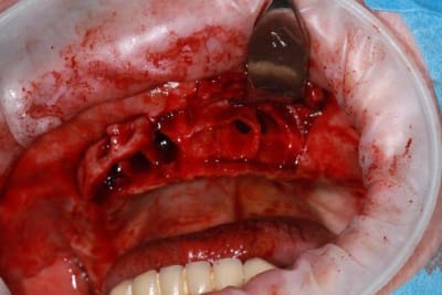 Img 1672 gj7k3g - Eugenol