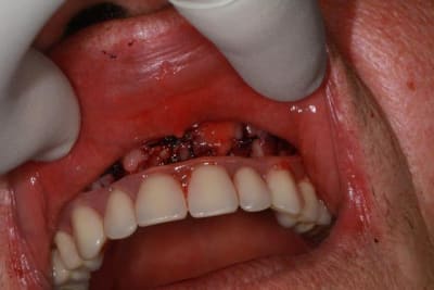 Img 1683 wyuusb - Eugenol