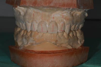 Img 1823 u0dq0b - Eugenol