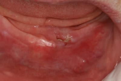 Img 1830 d3tufl - Eugenol