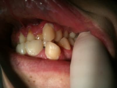 Img 1855 1  bqpaxr - Eugenol