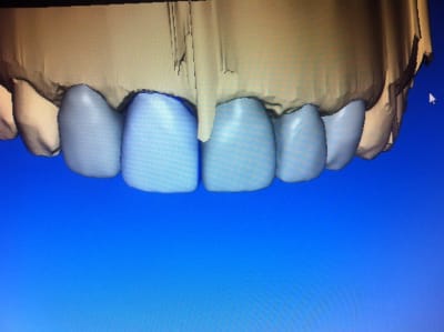 Img 1968 mazgxx - Eugenol